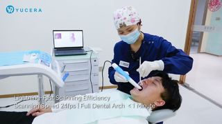 Presentazione di YRC-S05: rivoluziona la scansione digitale con precisione di 6μm e velocità fulminea!