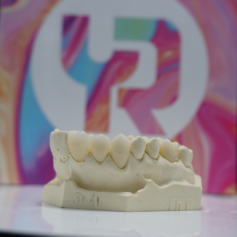 Disco De Zirconia De Alta Resistencia 4D Pro Disco De Zirconia Multicapa De Zirconia De Alta Translucidez Dental De Alta Calidad