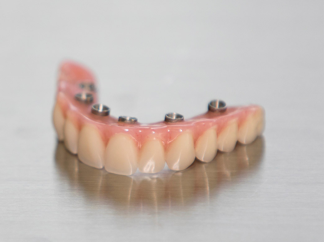 Yucera PMMA Monostrato Premium per Applicazioni Dentali, per Protesi Dentali Chiare e Resistenti