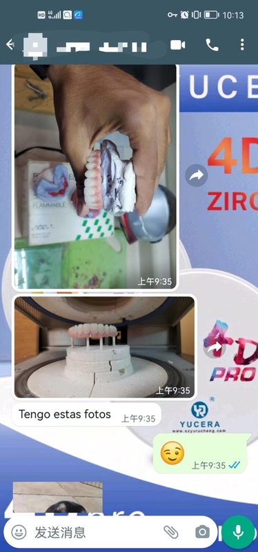 Yucera 4D Pro High - Blocco in ceramica di zirconia dentale ad alta trasparenza e alta luminosità paragonabile ai denti reali