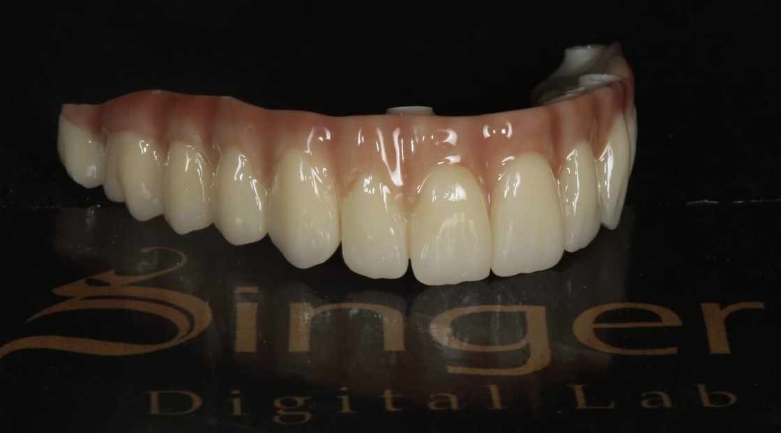 Yucera 4D Pro High - Blocco in ceramica di zirconia dentale ad alta trasparenza e alta luminosità paragonabile ai denti reali