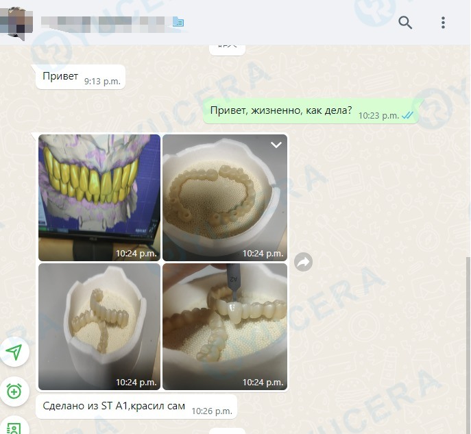 Blocco in zirconio dentale Yucera 4D Pro 95mm, dimensioni precise, adatto a diverse soluzioni di restauro dentale