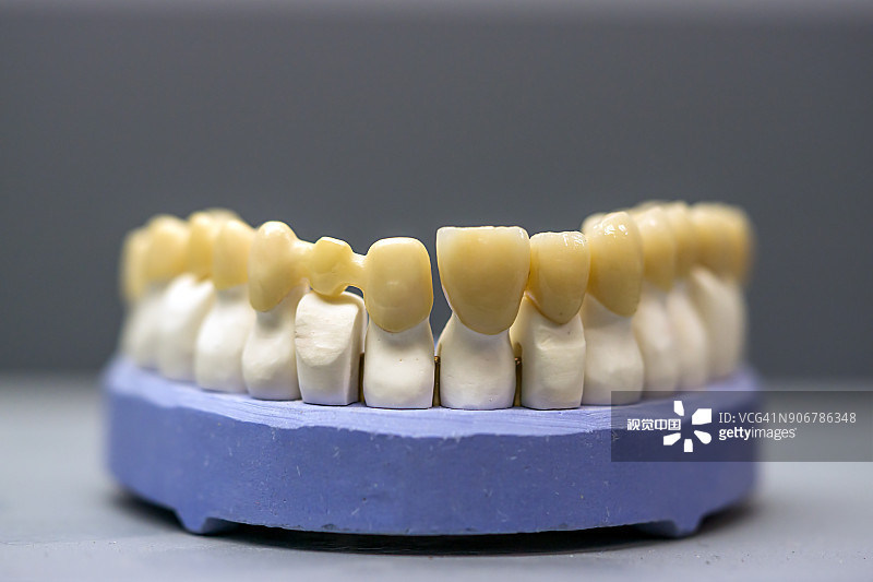Upgrade Your Dental Practice with Yucera STwhite Multilayer Zirconia Blocks