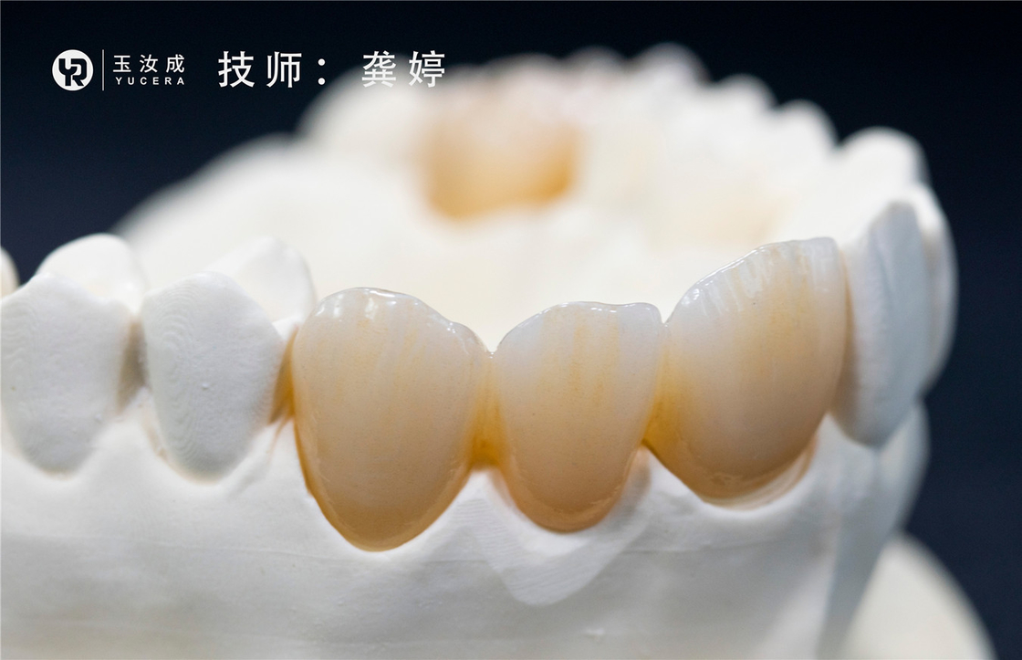 Yucera 3D più il sistema aperto del blocchetto 98x16mm di biossido di zirconio di Multilaer per la corona posteriore